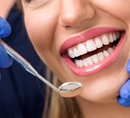 E Max Veneers in Turkey