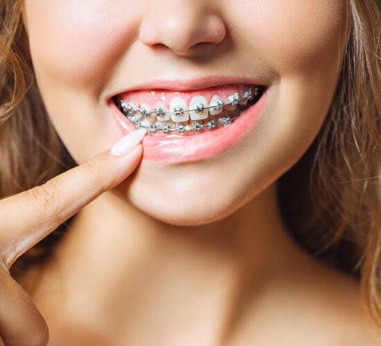 Orthodontic Treatments