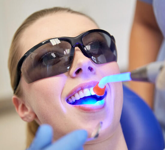 Dental Fillings